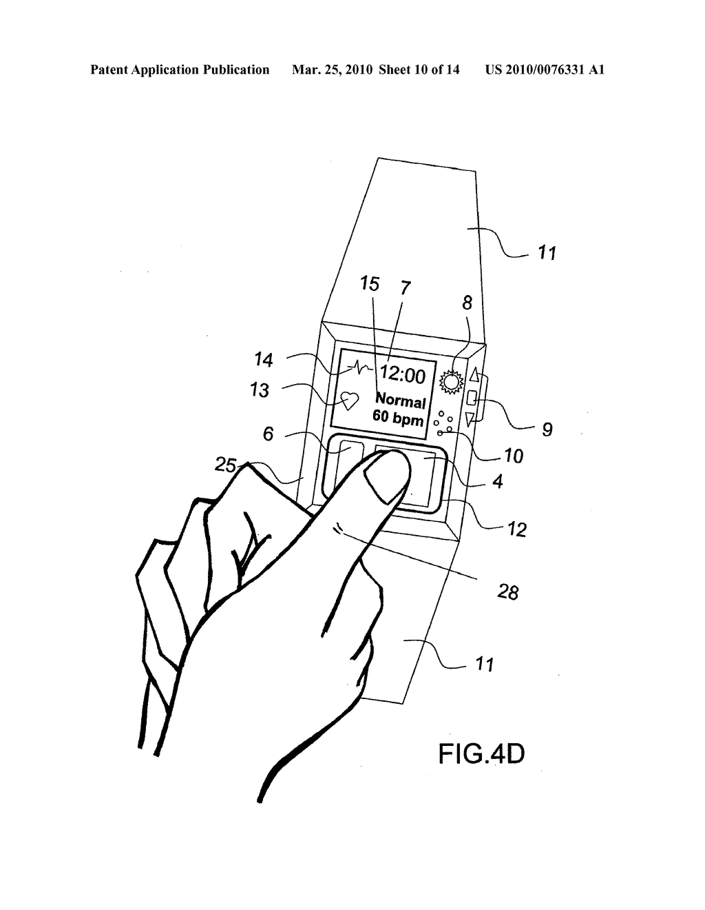 Device and Method for Measuring Three-Lead ECG in a Wristwatch - diagram, schematic, and image 11