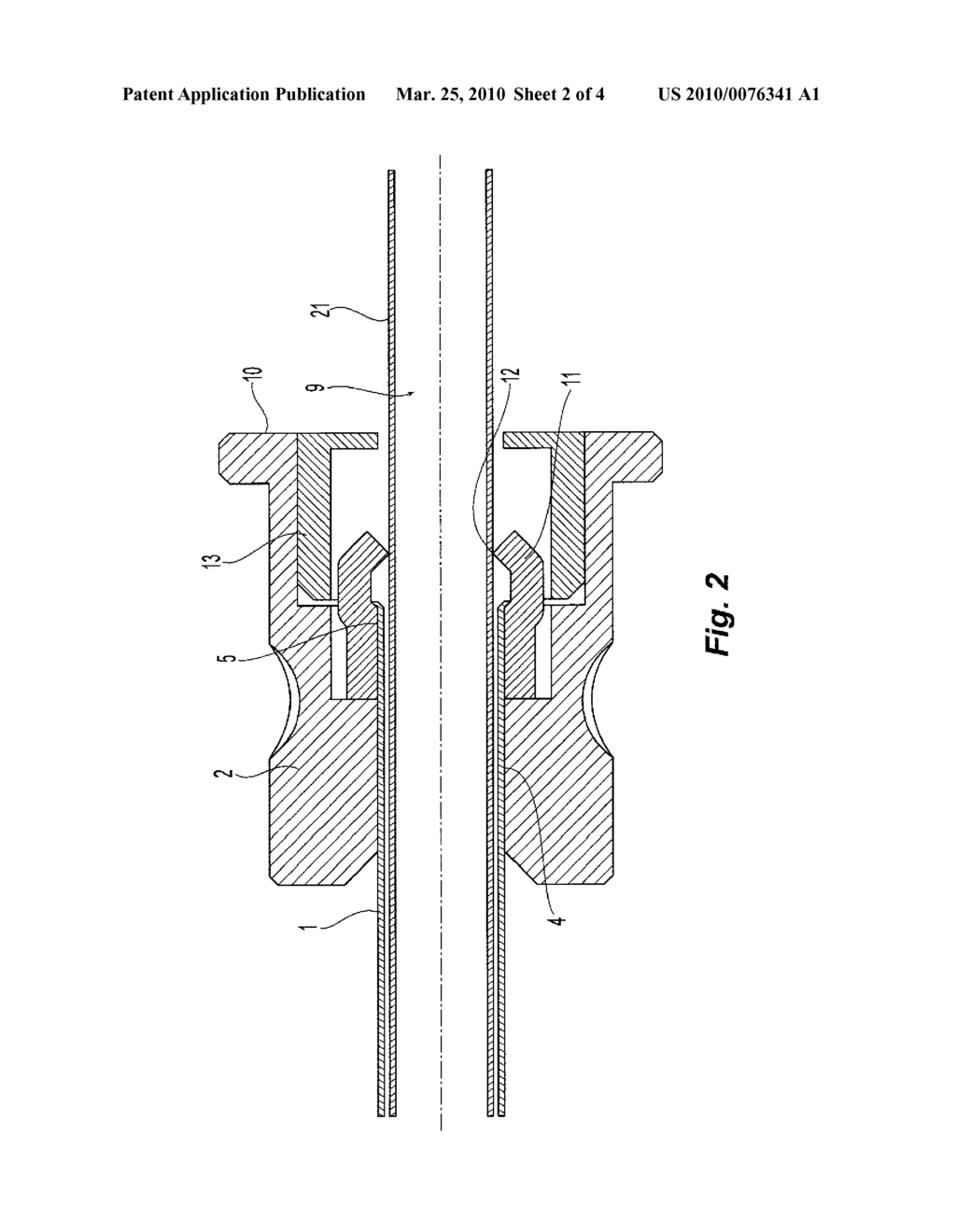 CANNULA PROVIDED WITH A SEALING ELEMENT FOR USE IN A MEDICAL PROCEDURE - diagram, schematic, and image 03