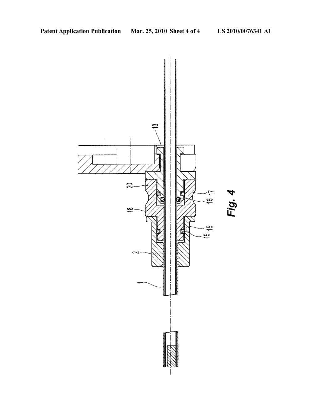 CANNULA PROVIDED WITH A SEALING ELEMENT FOR USE IN A MEDICAL PROCEDURE - diagram, schematic, and image 05