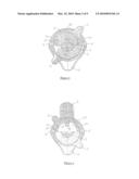 SPECULUM diagram and image