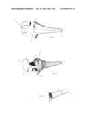 SPECULUM diagram and image