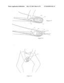 SPECULUM diagram and image