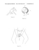 SPECULUM diagram and image