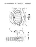 CATHETERS FOR USE IN THE SUBARACHNOID SPACE AND THE LIKE diagram and image