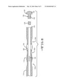 CATHETERS FOR USE IN THE SUBARACHNOID SPACE AND THE LIKE diagram and image