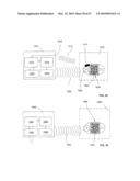 Remote control of substance delivery system diagram and image