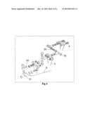 Device for facilitating the healing of bone including Olecranan diagram and image