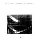 Device for facilitating the healing of bone including Olecranan diagram and image