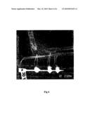 Device for facilitating the healing of bone including Olecranan diagram and image