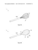 INFLATABLE MEDICAL DEVICES diagram and image