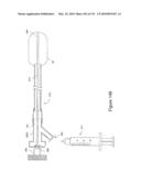 INFLATABLE MEDICAL DEVICES diagram and image