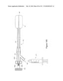 INFLATABLE MEDICAL DEVICES diagram and image