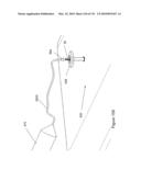 INFLATABLE MEDICAL DEVICES diagram and image