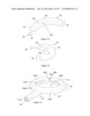 INFLATABLE MEDICAL DEVICES diagram and image