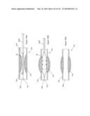 INFLATABLE MEDICAL DEVICES diagram and image