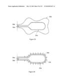 INFLATABLE MEDICAL DEVICES diagram and image