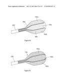 INFLATABLE MEDICAL DEVICES diagram and image