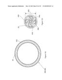 INFLATABLE MEDICAL DEVICES diagram and image