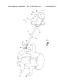 Surgical Instrumentation and Method for Treatment of a Spinal Structure diagram and image