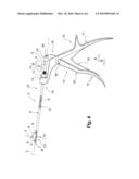 Surgical Instrumentation and Method for Treatment of a Spinal Structure diagram and image