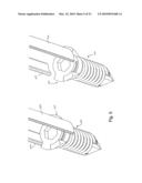 PLATING SYSTEM FOR BONE FIXATION AND METHOD OF IMPLANTATION diagram and image