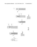 PLATING SYSTEM FOR BONE FIXATION AND METHOD OF IMPLANTATION diagram and image