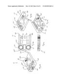 PLATING SYSTEM FOR BONE FIXATION AND METHOD OF IMPLANTATION diagram and image