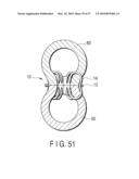 HOLLOW TISSUE INOSCULATION APPARATUS diagram and image