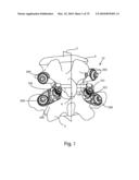 Facet Joint Replacement Instruments and Methods diagram and image