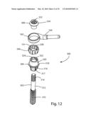 Facet Joint Replacement Instruments and Methods diagram and image