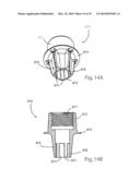 Facet Joint Replacement Instruments and Methods diagram and image