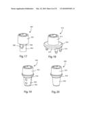 Facet Joint Replacement Instruments and Methods diagram and image