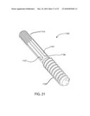 Facet Joint Replacement Instruments and Methods diagram and image