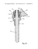 Facet Joint Replacement Instruments and Methods diagram and image