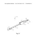 Facet Joint Replacement Instruments and Methods diagram and image