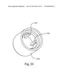 Facet Joint Replacement Instruments and Methods diagram and image