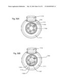 Facet Joint Replacement Instruments and Methods diagram and image