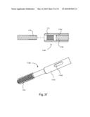 Facet Joint Replacement Instruments and Methods diagram and image