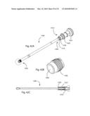 Facet Joint Replacement Instruments and Methods diagram and image