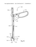 Facet Joint Replacement Instruments and Methods diagram and image