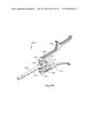 Facet Joint Replacement Instruments and Methods diagram and image