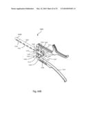 Facet Joint Replacement Instruments and Methods diagram and image