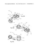 Facet Joint Replacement Instruments and Methods diagram and image