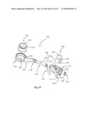 Facet Joint Replacement Instruments and Methods diagram and image