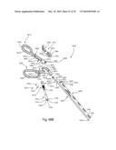 Facet Joint Replacement Instruments and Methods diagram and image