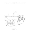 Facet Joint Replacement Instruments and Methods diagram and image