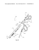 Facet Joint Replacement Instruments and Methods diagram and image