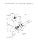 Facet Joint Replacement Instruments and Methods diagram and image