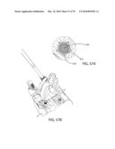 Facet Joint Replacement Instruments and Methods diagram and image