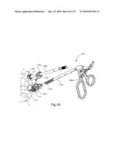 Facet Joint Replacement Instruments and Methods diagram and image